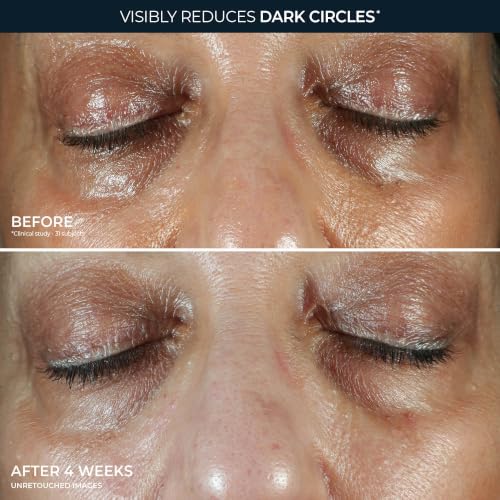 RoC Multi Correxion 5 in 1 Anti-Aging Eye Cream | Dark Circles & Puffiness