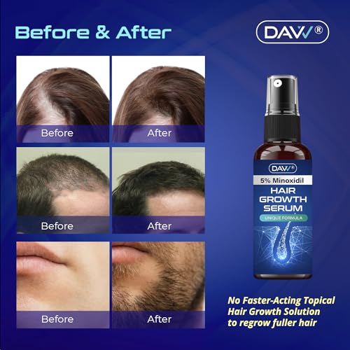 5% Minoxidil Hair Growth Serum For Men And With Biotin Hair Regrowth Treatment For Stronger Thicker Longer Hair help to Stop Thinning and loss hair 60 ML