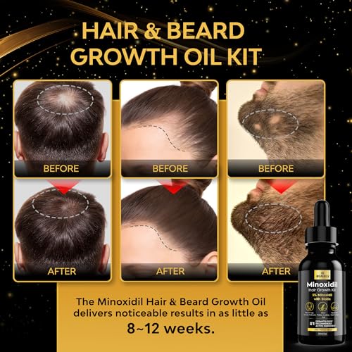 Minoxidil 5% Beard Growth Kit for Men & Women
