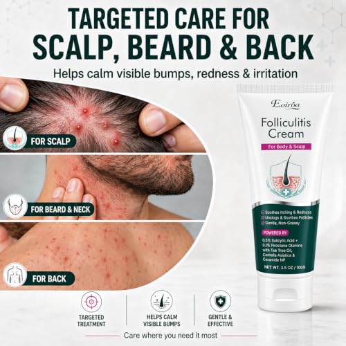 Eoiroa Folliculitis Cream for Scalp & Body Bumps - Fast-Acting Acne & Razor Bump Treatment, 3.5 oz