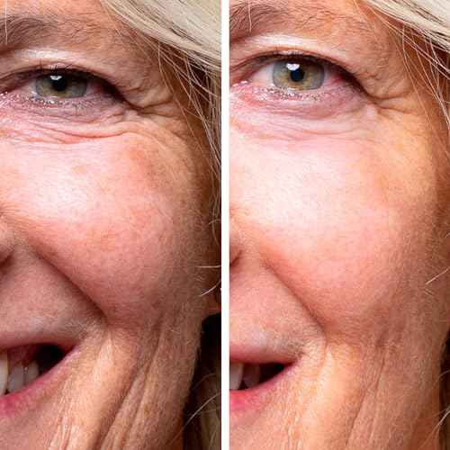 COCUNAT - The Cure - Anti-Ageing Facial Serum - Repairs and Redensifies - Targets Wrinkles, Luminosity and Nourishment - 21 Essential Oils, Antioxidants, Vitamins, Fatty Acids and Bakuchiol - 30 ml