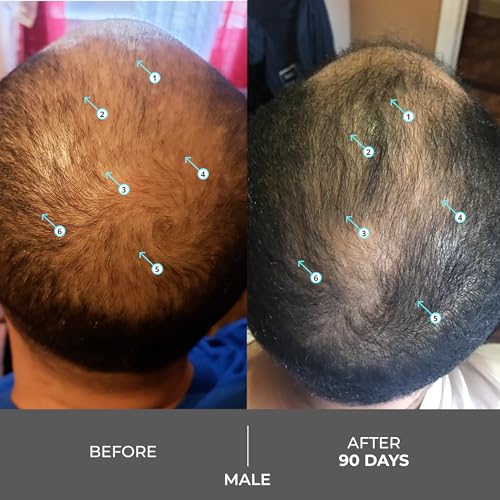 DS Labs Revita Extra Strength Shampoo 205mL | Fuller Hair