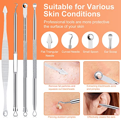 15 PCS Blackhead Remover Tool Kit | Professional Acne Extraction Set