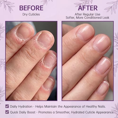 Cuticle Oil Pen - Hydrating Nail Moisturizer with Jojoba & Vitamin E