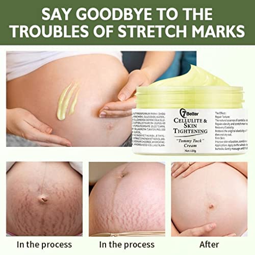 Pregnancy Stretch Mark & Scar Removal Cream