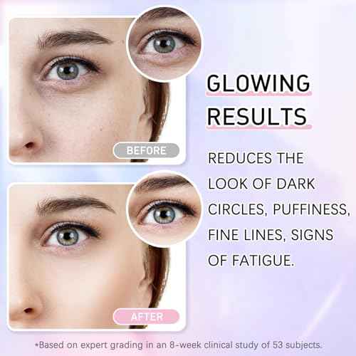 Caffeine Eye Serum Cream Kit for Dark Circles Under Eye Treatment Retinol Cream Anti Aging For Puffiness Bags And Wrinkles 2 Fl Oz