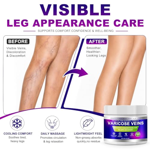 Varicose Veins Cream for Legs - Arnica & Aloe Vera 2-Pack
