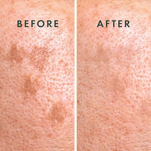 Rael Miracle Microcrystal Vitamin C Dark Spot Patches (9 Ct)