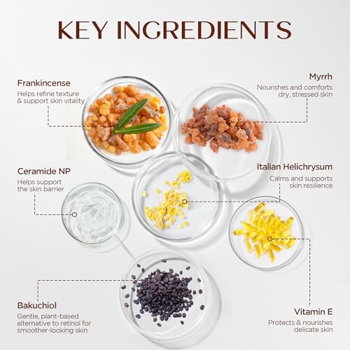 Vigority Frankincense Balm: Whipped Revitalizes & Smooths Cream for Dry, Mature & Aging Skin with Helichrysum & Bakuchiol? Moisturizer & Nourishes for Face & Body - Lightweight & Non-greasy ? 3.4 oz