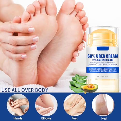 60% Urea Foot Cream with Salicylic Acid for Cracked Heels