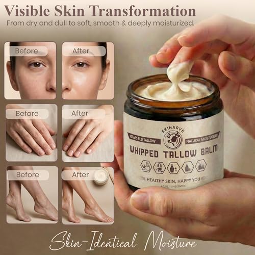 Beef Tallow for Skin 4oz Unscented, Organic Whipped beef Tallow and Honey Balm, 100% Grass Fed Beef Tallow Face Moisturizer For Dry Skin, Lip balm, Eczema Natural Tallow Moisturizer Lotion Body Butter