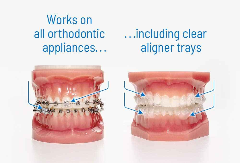 OrthoDots Clear – 24-Hour Protection | Sticks Better Than Dental Wax | Moisture Activated Braces Wax Alternative for Pain Caused by Braces, Clear Aligner Trays, and Other Orthodontic Appliances