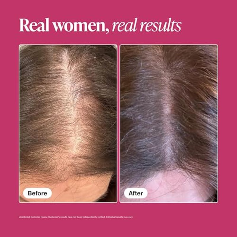 Hair Growth Supplements for Women - Thicker & Fuller Hair