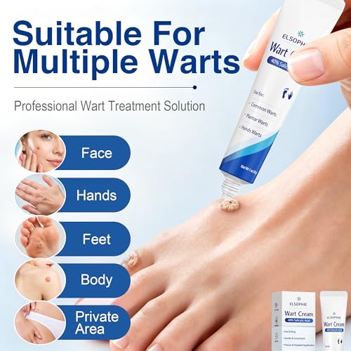 40% Salicylic Acid Wart Remover Cream - 1 oz