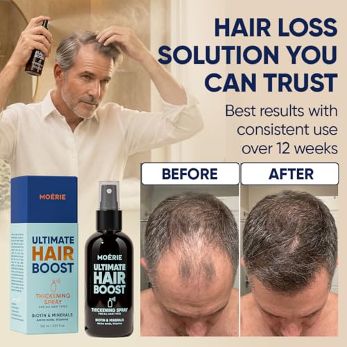 Moerie Hair Growth Serum Spray - Biotin & Rosemary for Men & Women