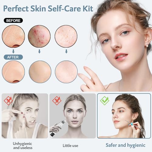 MENOLY 10-Piece Pimple Popper Tool Kit for Blackheads & Acne