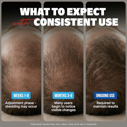 Kirkland Minoxidil 5% Hair Regrowth Treatment for Men, 6-Month Supply