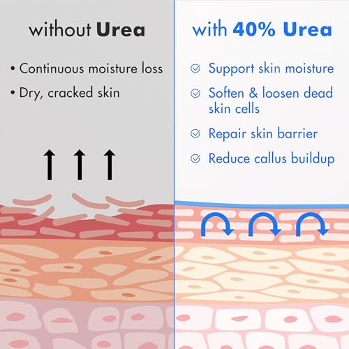 Ebanel Urea Cream 40% with Salicylic Acid - 2PK for Dry Cracked Skin