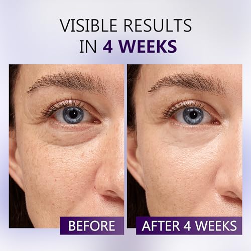 Caffeine Eye Cream for Dark Circles - 5% Caffeine Eye Serum Infused with Collagen and Niacinamide, Cream for Puffines and Bags Under Eyes w/ 360¡Æ Depuffer Roller