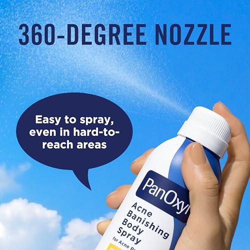 PanOxyl Acne Banishing Body Spray with 2% Salicylic Acid, Pimple Treatment Spray to Clear Stubborn Breakouts, 360-Degree Spray Nozzle, Skin-Brightening Niacinamide, Vitamin C, Witch Hazel, Aloe, 6 Oz