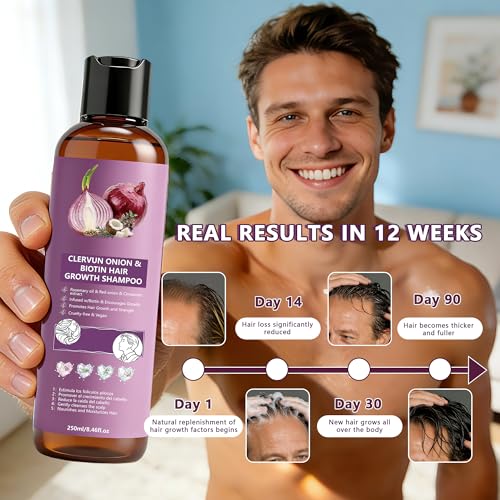 Onion Biotin Shampoo for Hair Growth & Volume