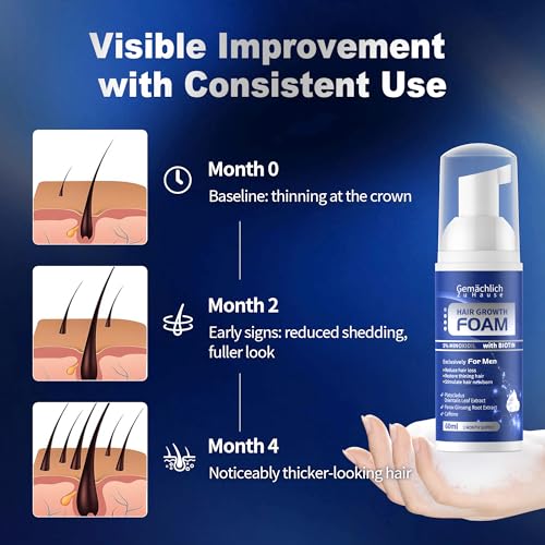 5% Minoxidil Foam for Men Hair Regrowth - 60ml