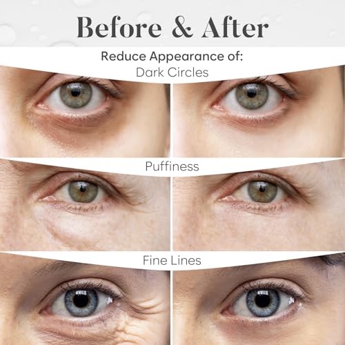 BLOOMORA Under Eye Patches Variety Pack (30 Pairs)