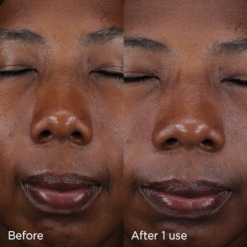 IMAGE Skincare Daily Prevention Tinted Moisturizer SPF 30