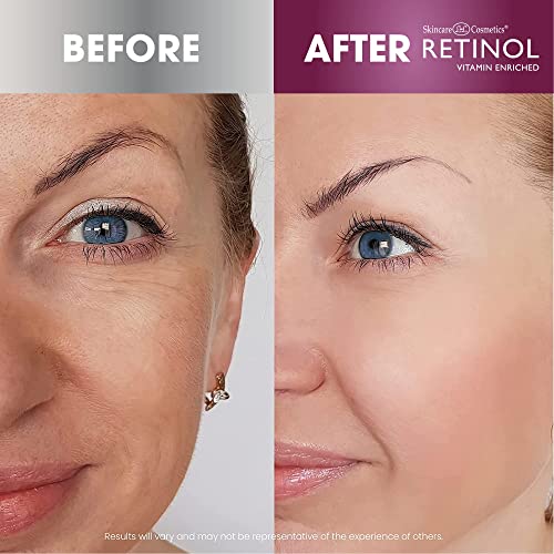 Retinol Instant Radiance Booster - Provides A Burst of Anti-Aging Hydration and Luminosity + Retinol Anti-Aging Day Cream Broad Spectrum SPF 20 Moisturizes & Reduces Look of Fine Lines.