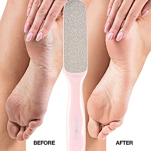 Probelle Double Sided Multidirectional Nickel Foot File Callus Remover - Immediately reduces calluses and corns to powder for instant results, safe tool (Pink)