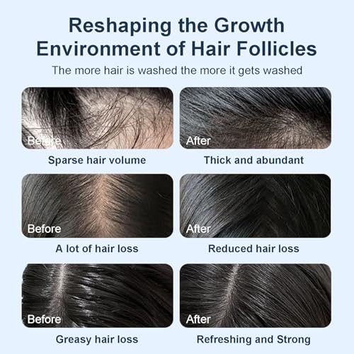 Tgideas Biotin Hair Growth Shampoo for Thinning Hair