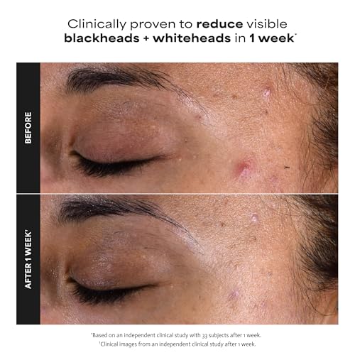 Paula's Choice 2% BHA Liquid Exfoliant - Gentle Facial Polish for Pores & Wrinkles