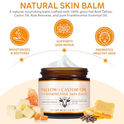 Tiuedu Tallow, Castor Oil and Frankincense Oil Skin Balm, 100% Grass-Fed Tallow for Face & Body Moisturizer, Deep Moisturizing Cream, Moisturizer for Dry, Cracked Skin, All Skin Types