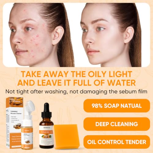 Turmeric Face Wash Set with Soap & Oil for Acne & Radiant Skin – Femani