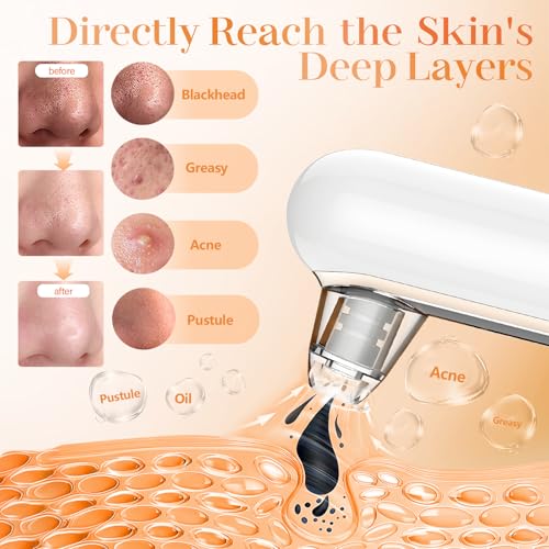 Yccu Blackhead Remover Vacuum with 4 Modes & 5 Heads