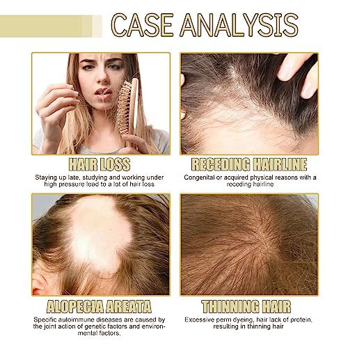HuaQing Natural Rosemary Hair Growth Oil - 180 ML for Damaged Hair