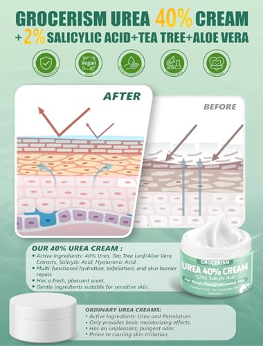 Grocerism 40% Urea Cream with Salicylic Acid for Feet & Hands