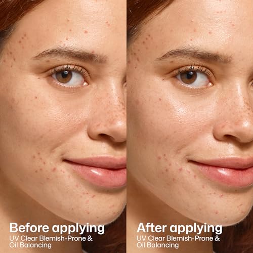 EltaMD UV Clear SPF 50 Face Sunscreen for Blemish-Prone Skin - 1.7 oz (Variation: New Blemish Prone)