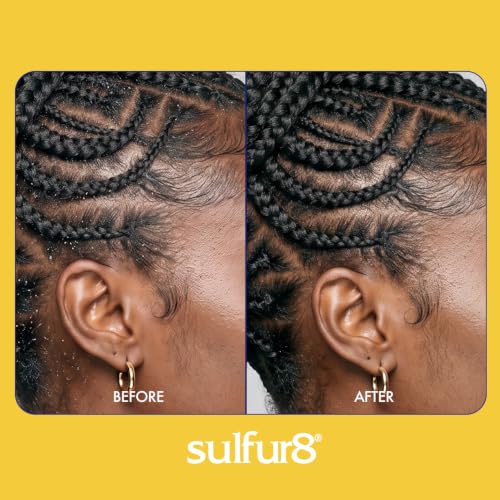 Sulfur 8 Dandruff Treatment Spray for Braids 12 oz