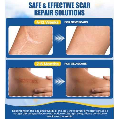 Medical Grade Silicone Scar Sheets & Tape - 1.6¡±x60" Roll, Ultra Soft, Hypoallergenic Rolls for Surgical, Keloid Scars, Tummy Tuck, C-Section, Stretch Marks, Burn & Bumps Scar Removal, 24H Comfortable