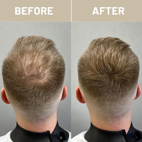 Hair Fibers for Thinning Hair - Instant Coverage 28g
