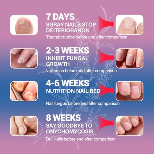 Extra Strength Toenail and Foot Fungus Treatment 2-Pack