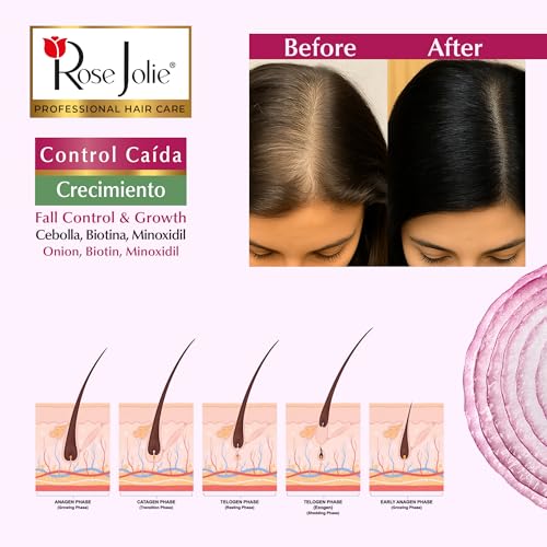 Rose Jolie Onion & Biotin Shampoo & Conditioner Set - Hair Fall Control, Sulfate & Paraben Free