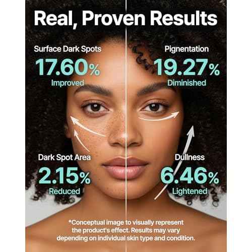 Charde Niacinamide 25% Snow Ampoule for Face, Dark Spot Care for Hyperpigmentation, Freckles & Sun Spots | Radiance Boosting with White Garcinia & Arbutin, Korean Skin Care, 1.01 fl. oz.