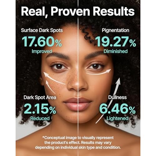 Charde Niacinamide Brightening Serum for Dark Spots & Uneven Tone | Radiance Boosting with White Garcinia & Arbutin, Korean Skincare, 1.01 fl oz