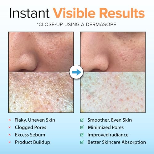 Ebanel Brightening Peeling Gel – Gentle Exfoliator for Face & Body