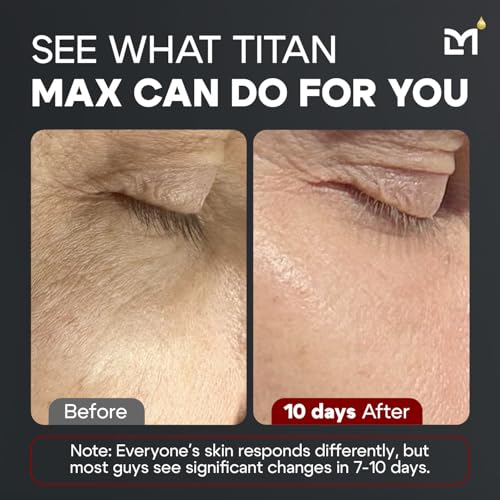 Titan MAX Anti-Aging Face Serum for Men ? Ultra Potency Mens Face Lotion ? Skin Tightening Cream for Face ? Mens Skin Care ? Vitamin C & E, 10% Niacinamide, Hyaluronic Acid ? Unscented