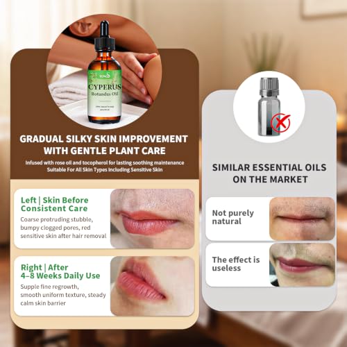 Cyperus Rotundus Oil with Sweet Almond & Rosehip – Soothing Hair Removal Oil