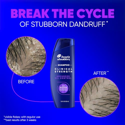 Head & Shoulders Dandruff Shampoo, Clinical Strength Advanced Oil Control, Our Maximum Anti-Dandruff Prescription-Strength Formula, Flake Protection, Seborrheic Dermatitis Relief, Citrus, 13.5 Fl Oz
