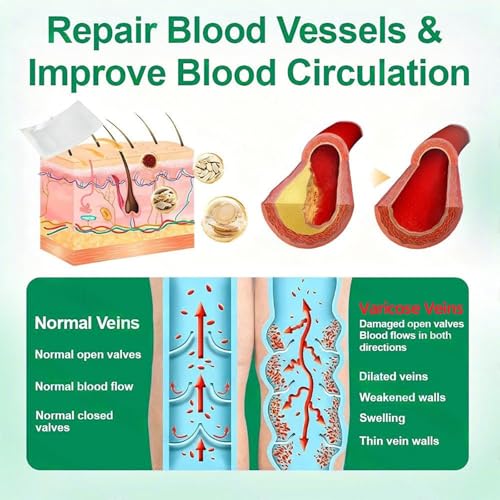 Varicose Veins Patch for Legs - Relief & Skin Smoothing (4 Pack)